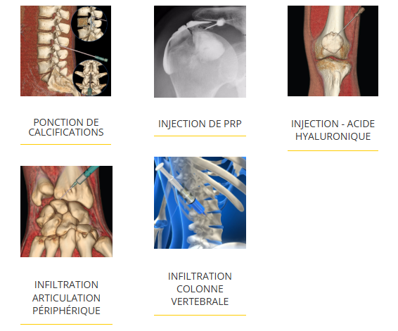 interventional radiology radiologie interventionnelle à paris